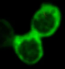 Three connected fuzzy green circular cells on black background