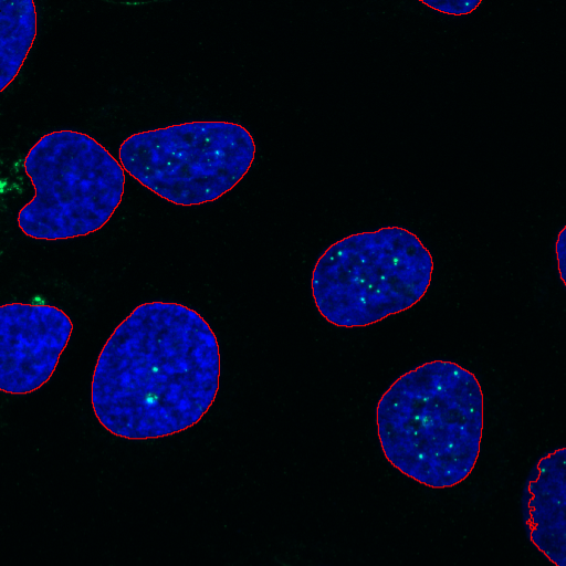 Blue fluorescent cell nuclei with green puncta, red outlines on a black background