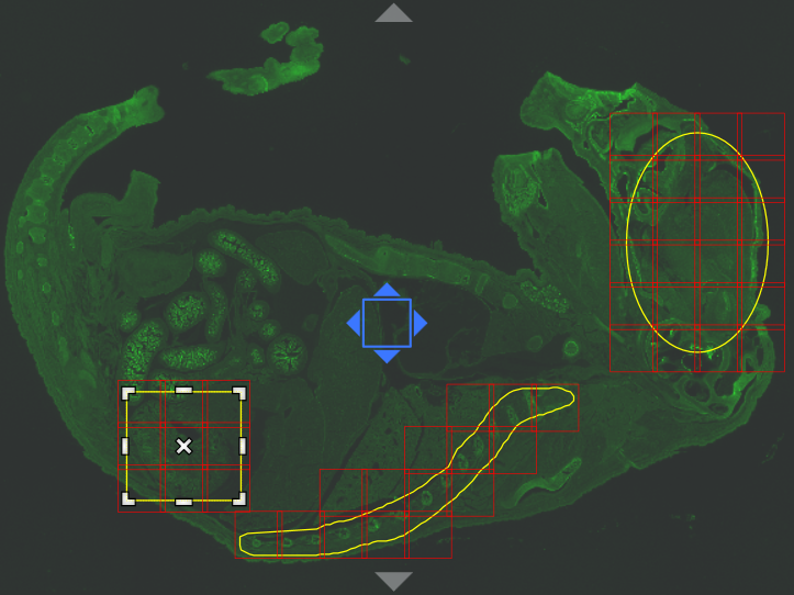 Green fluorescent tissue with red tile grid, yellow outlines, blue square marker, and white selection box with X