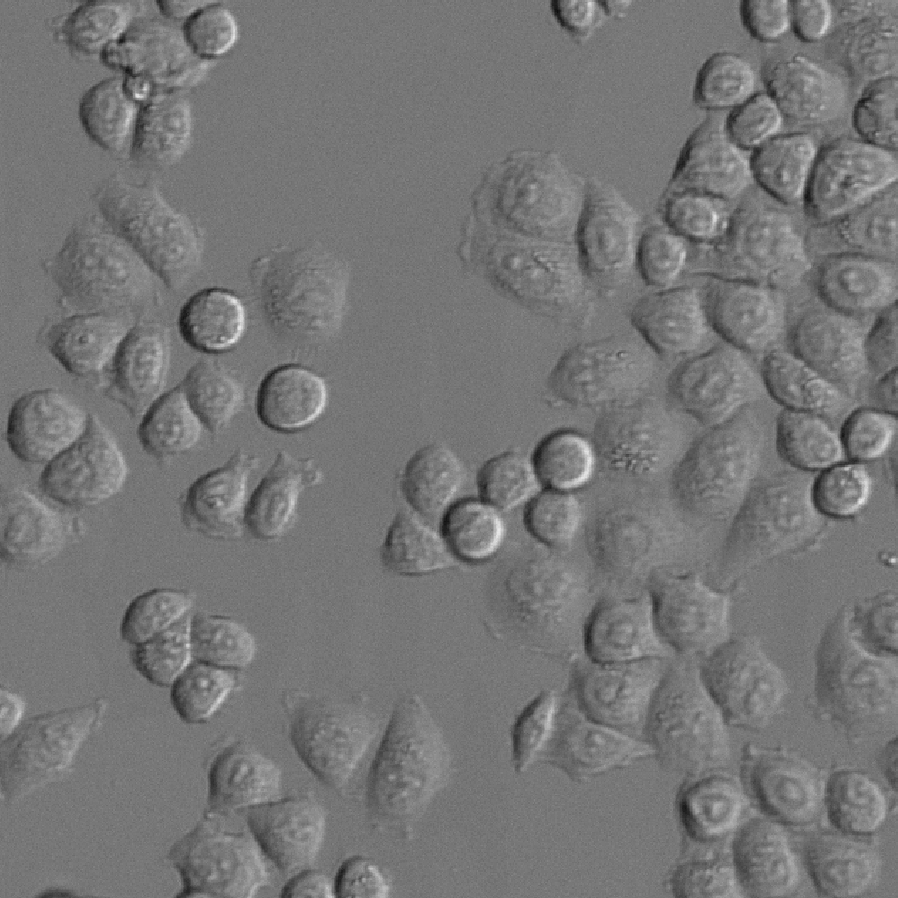 Grayscale micrograph of clustered round and irregular cells