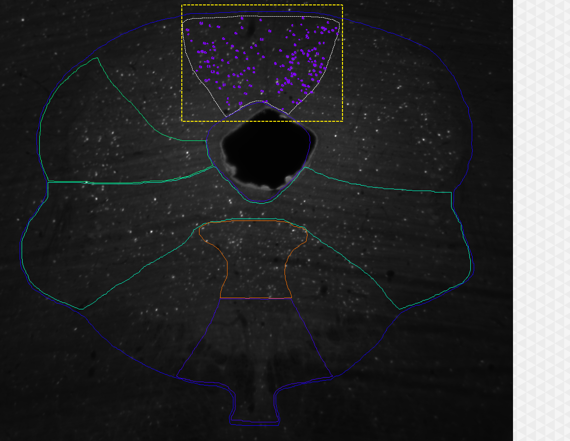 Grayscale spinal section with colored region outlines, central dark cavity, yellow dashed box marking a region with purple dot markers