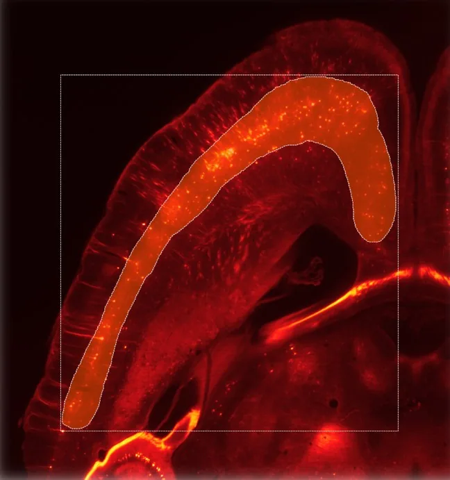 Red fluorescent tissue with dotted rectangular ROI and orange irregular highlighted region overlay