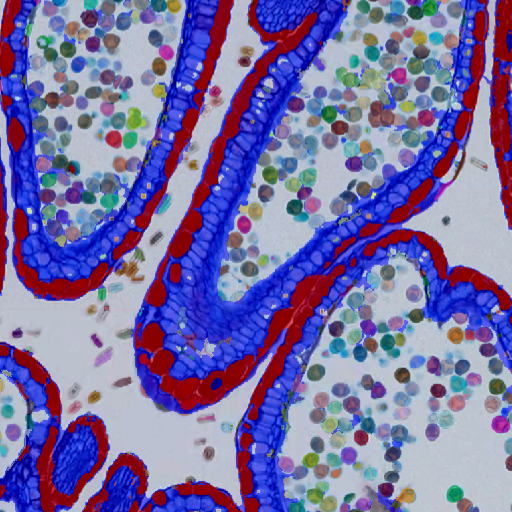 Microscopic image of curved tubular structures outlined in blue and red over a field of multicolored circular dots