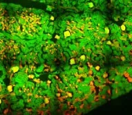 Green textured area with numerous yellow and orange irregular spots and pronounced dark border shading