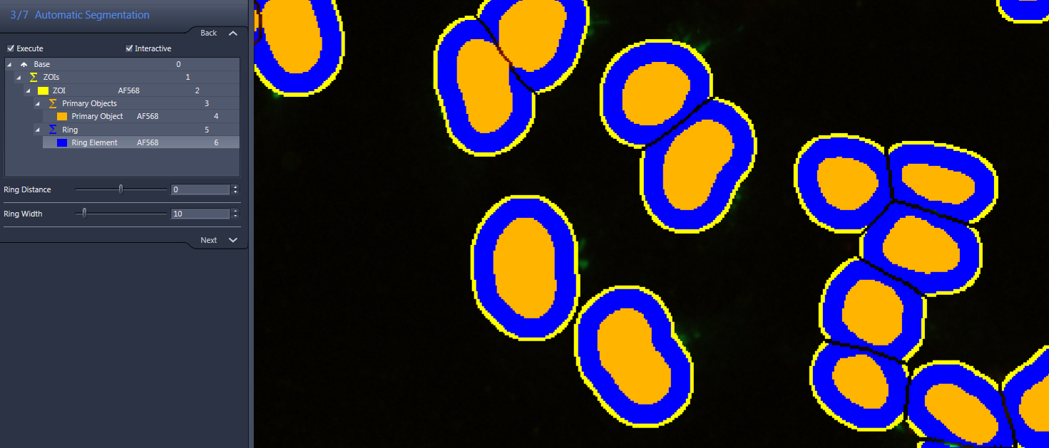 Automatic Segmentation panel left shows ZOI, Primary Objects, Ring; orange ovals with blue rings and yellow outlines on dark