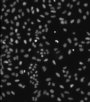 Grayscale image showing many bright oval nuclei scattered on a dark background