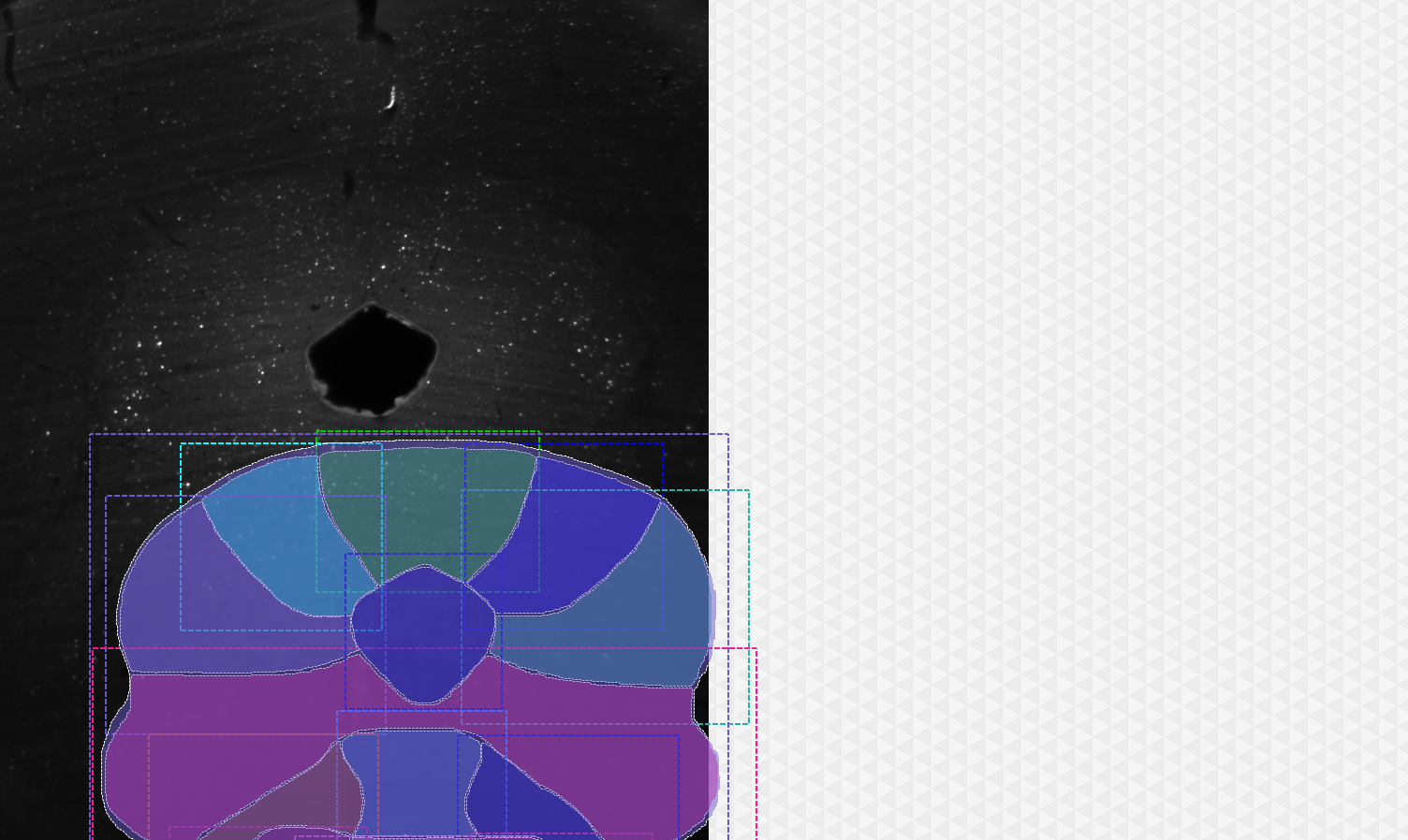 2D viewer with colored segmented object overlays and dashed selection boxes on dark background