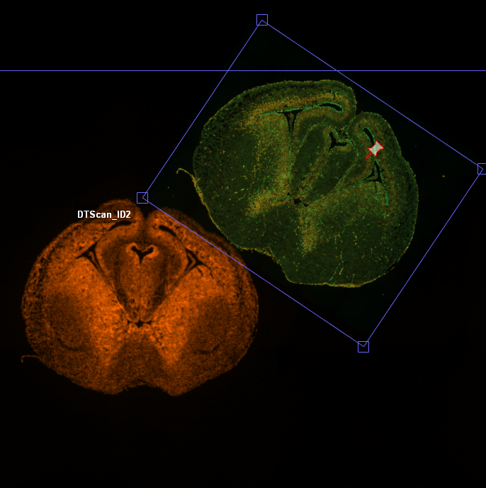 Orange fluorescent brain slice labeled DTScan_ID2 and a rotated green slice with blue corner handles and red pin