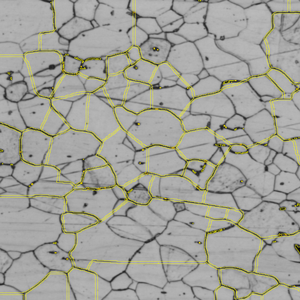 Grayscale micrograph showing polygonal cells outlined in yellow with scattered dark spots.