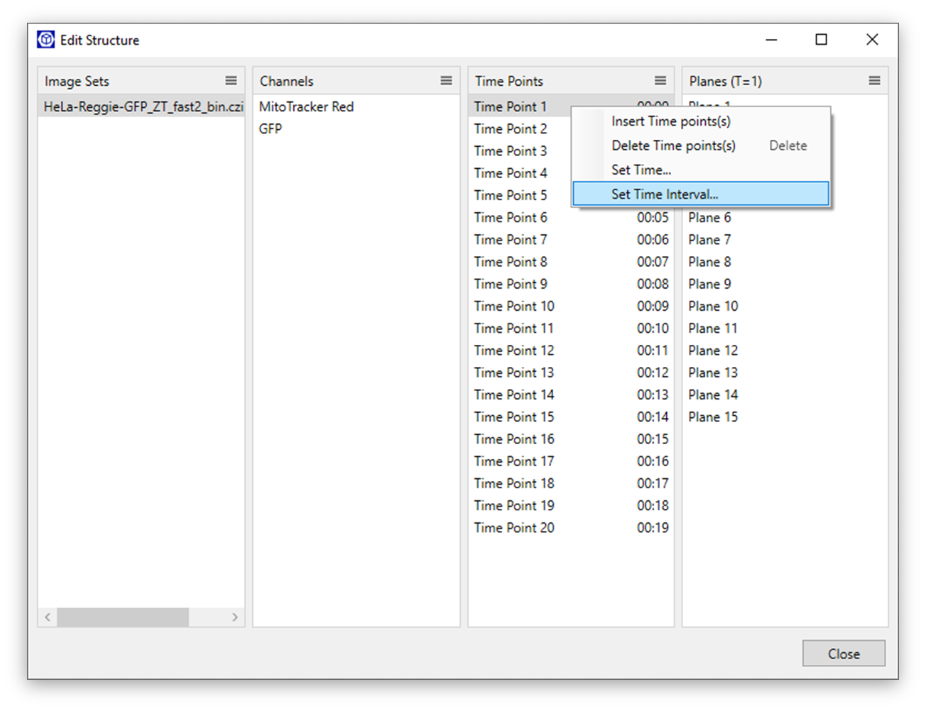 Edit Structure dialog with Image Sets, Channels (MitoTracker Red, GFP), Time Points list and Set Time Interval context menu