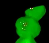 High opacity example on the green channel at left, small graph showing Intensity → Opacity