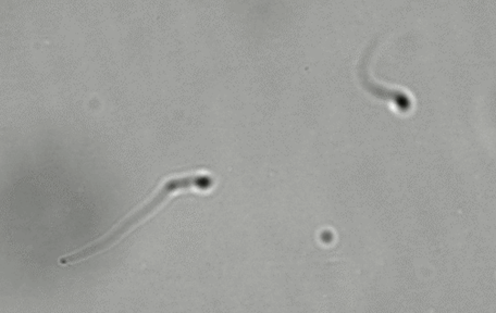 Microscopy image of two elongated curved objects with dark rounded heads and tails on a gray background