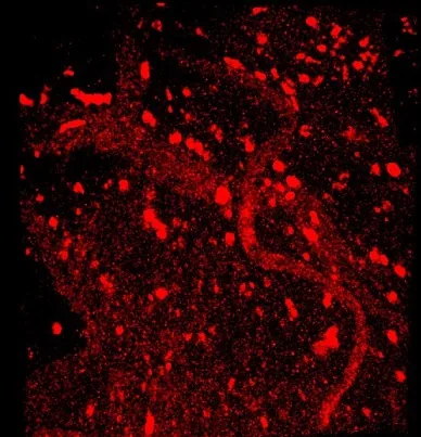Red fluorescence microscopy image with punctate and curved bright structures on black background