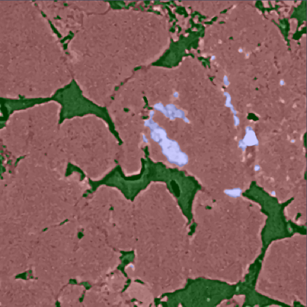 Overlay of XRM and segmentation showing brown-tinted particles with green and pale-blue segments