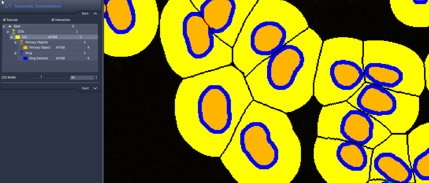 Segmentation screenshot with yellow ZOI regions around oval objects, blue rings and orange centers; left panel ZOI Width 30