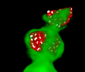 Low opacity example on the green channel at right, small graph showing Intensity → Opacity