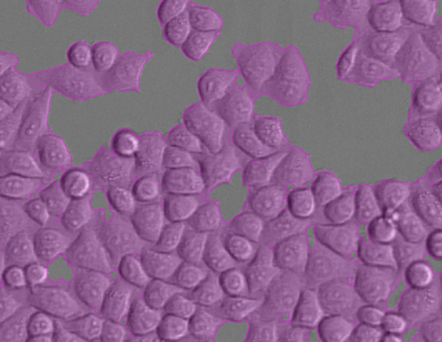 Grayscale cells with purple translucent segmentation overlay highlighting cell regions
