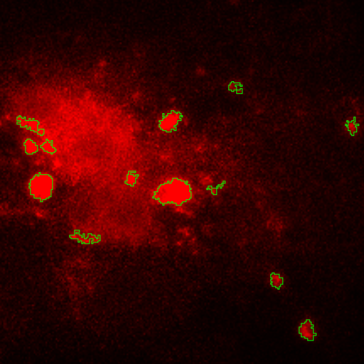 Dark image with scattered bright red blobs outlined in green on a diffuse red background