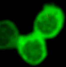 Three blurred bright green circular fluorescent shapes on a black background