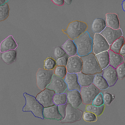 Cluster of irregular gray blobs outlined with thin multicolored contours on a gray background