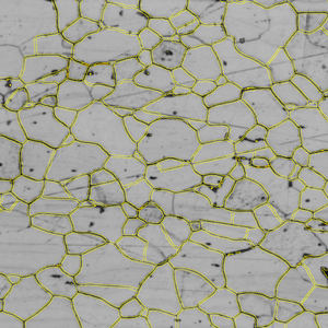 Grayscale micrograph of polygonal cells outlined in yellow with scattered dark spots