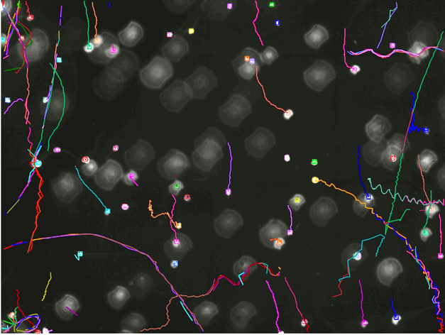 Dark-field image of bright circular blobs with multicolored tracked paths overlaid