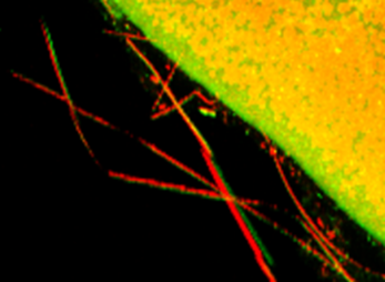 Close-up image of red dotted filaments along the border between a black area and a green-yellow textured region