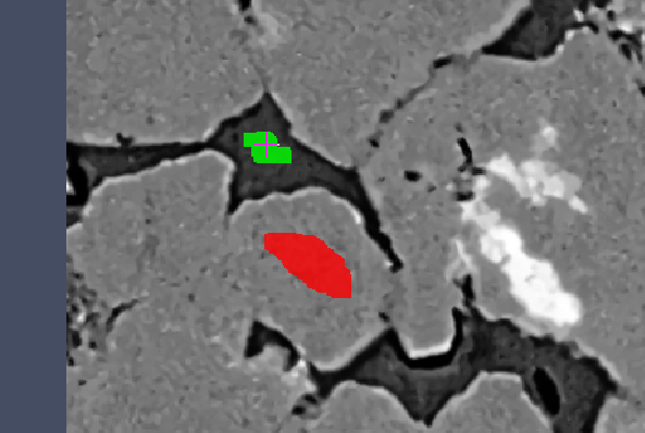 Close-up grayscale image with a red labeled region and a green label crosshair