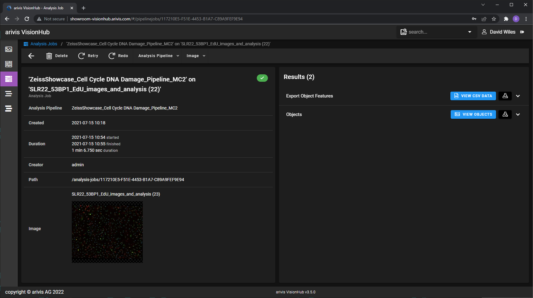 arivis VisionHub analysis job details for 'ZeissShowcase_Cell Cycle DNA Damage_Pipeline_MC2'