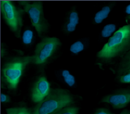 Fluorescence microscopy image of blue-stained nuclei and green-stained cell structures on black background