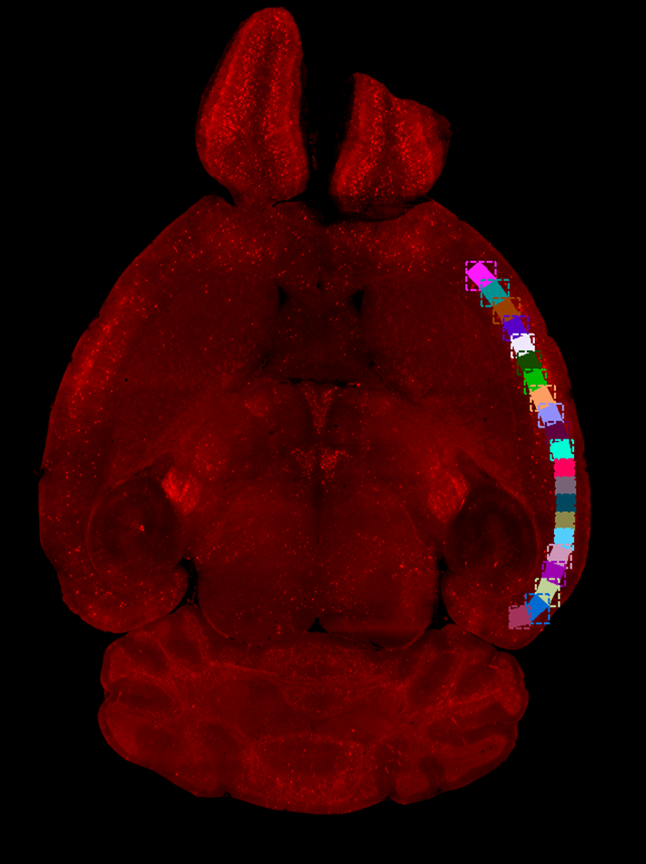 Red fluorescent brain section with a curved column of multicolored square markers along the right edge