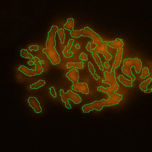 Cluster of irregular orange blobs outlined in green on a dark background