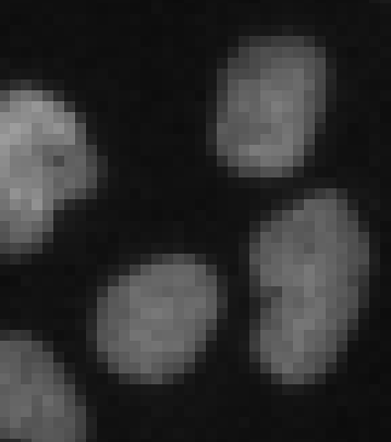 Pixelated light-gray rounded blobs on black background