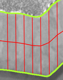 Grayscale sample crop showing green boundaries and vertical red measurement chords