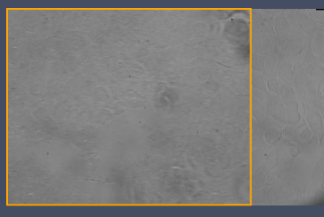 Grayscale microscope image of textured sample with orange rectangular overlay and faint shadow at lower center.