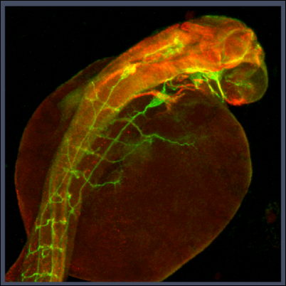 Merged red and green fluorescence image of a curved tubular structure adjacent to a round mass on black background
