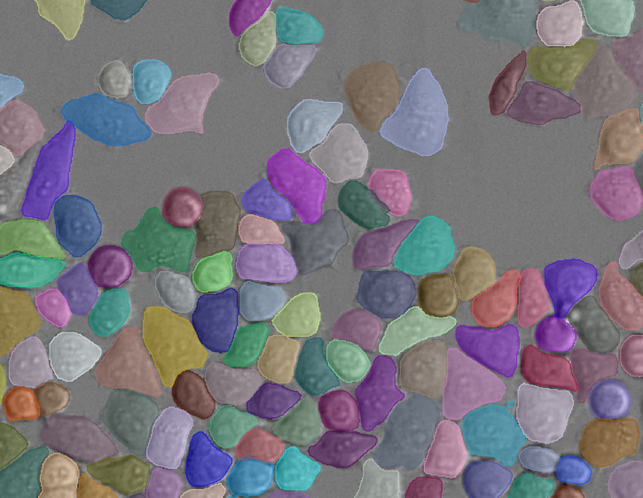 Grayscale cells with multicolored segmented overlays labeling individual cells