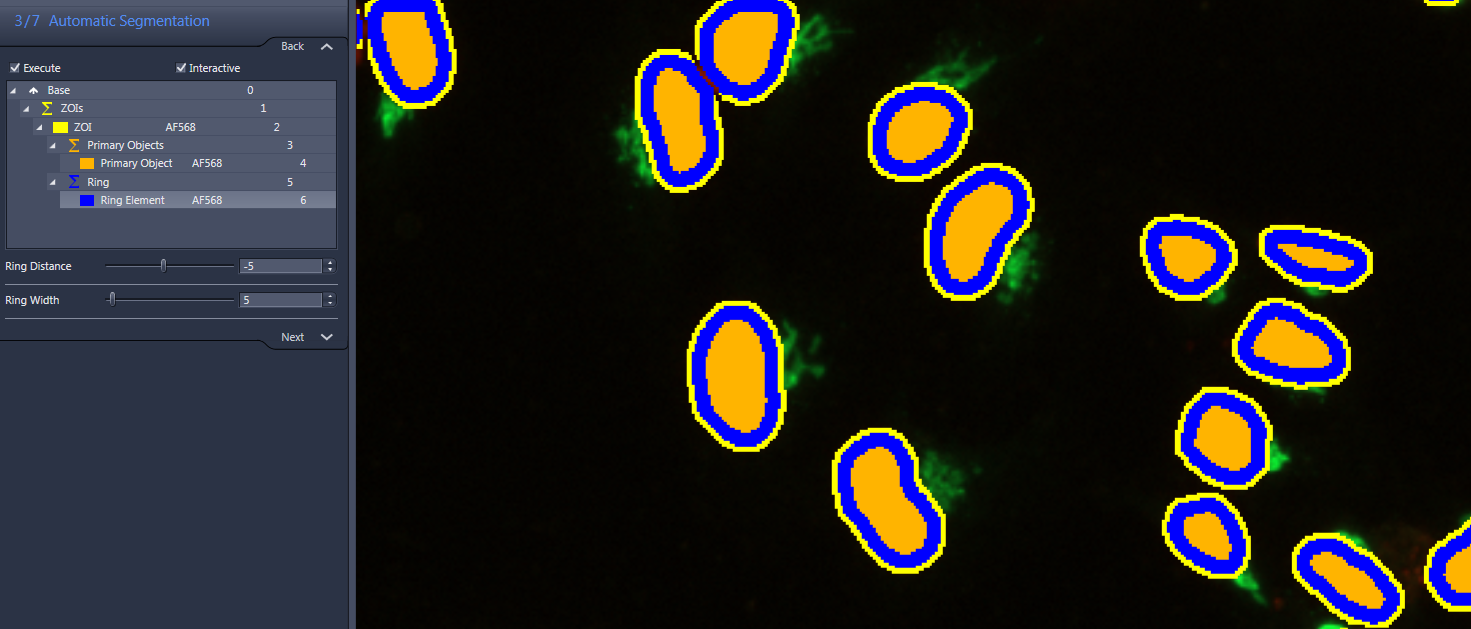 Segmentation screenshot showing oval objects with orange centers, blue rings and yellow ZOI overlays; left panel 3/7