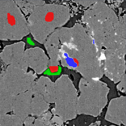 Grayscale XRM image with small red, green and blue labeled regions on particles