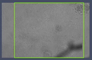 Grayscale microscope image of textured sample with green rectangular overlay and dark diagonal shadow.
