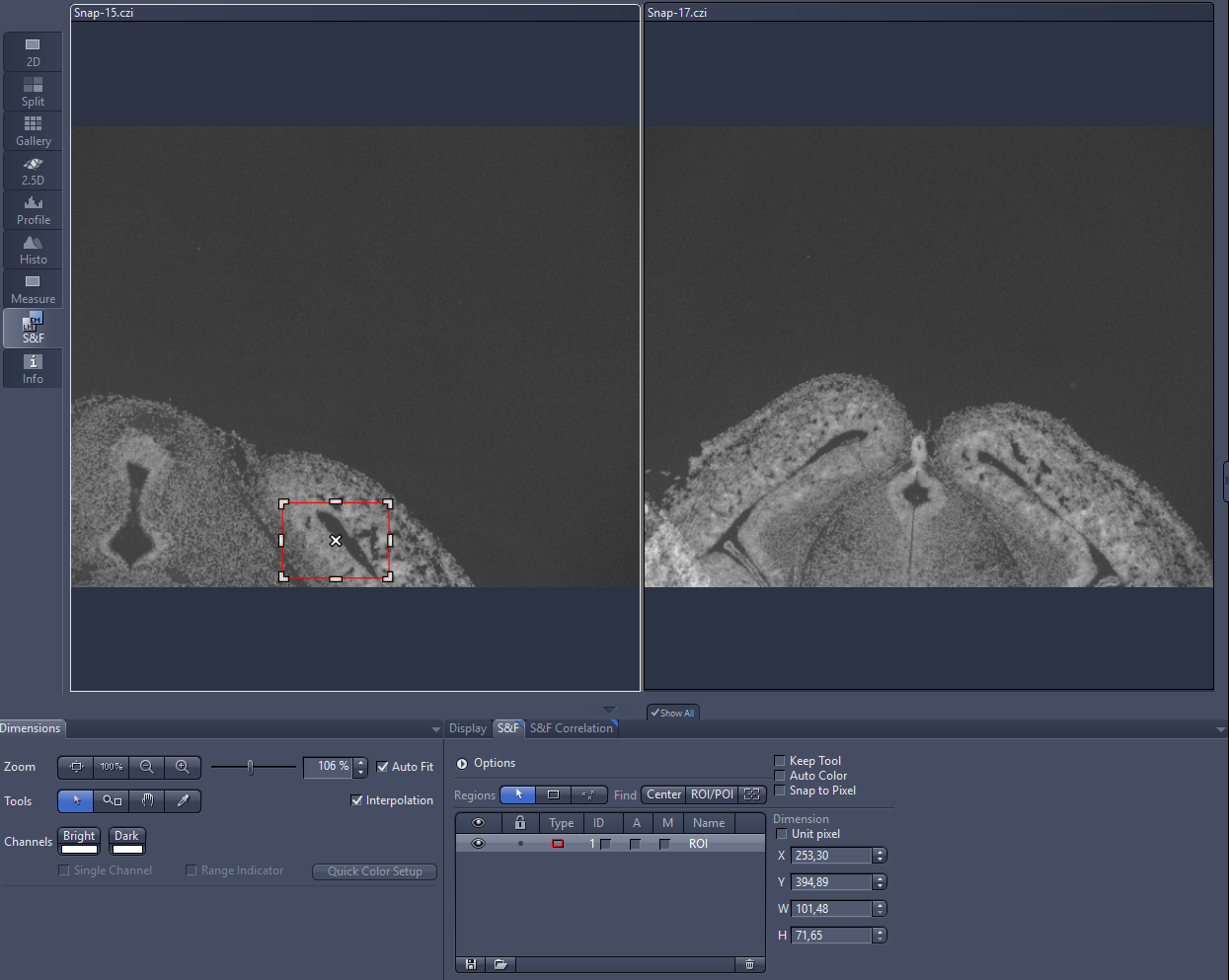 ZEN software Shuttle & Find view showing two grayscale microscopy panels labeled Snap-15.czi and Snap-17.czi with ROI box