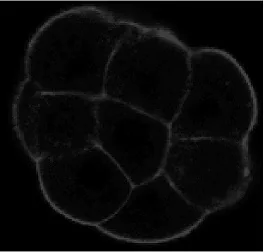 Microscopy image of a cluster of faintly outlined rounded cells on a black background