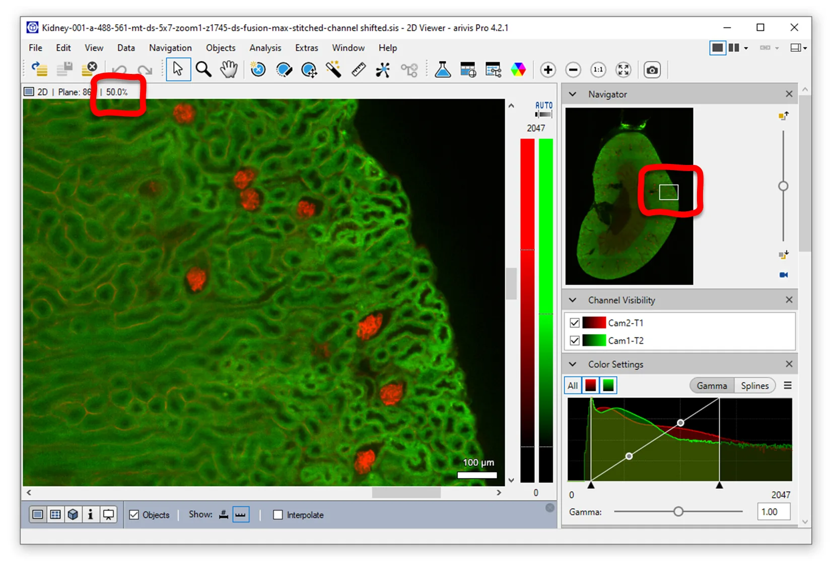 Arivis 2D viewer showing kidney tissue in green with red spots, 50.0% zoom, navigator inset and 100 µm scale bar