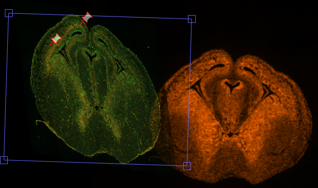 Rotated green brain slice with two red pin markers in a blue bounding box overlapping an orange fluorescent brain slice