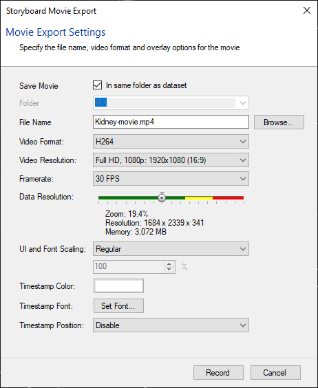 Storyboard Movie Export: File Kidney-movie.mp4; Format H264; Resolution Full HD 1080p; Framerate 30 FPS