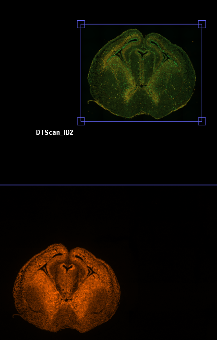 Overlapping fluorescent tissue sections on black background; orange labeled DTScan_ID2, green with blue box and red pin