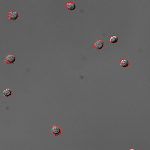 Gray background with multiple round dark blobs each outlined in red