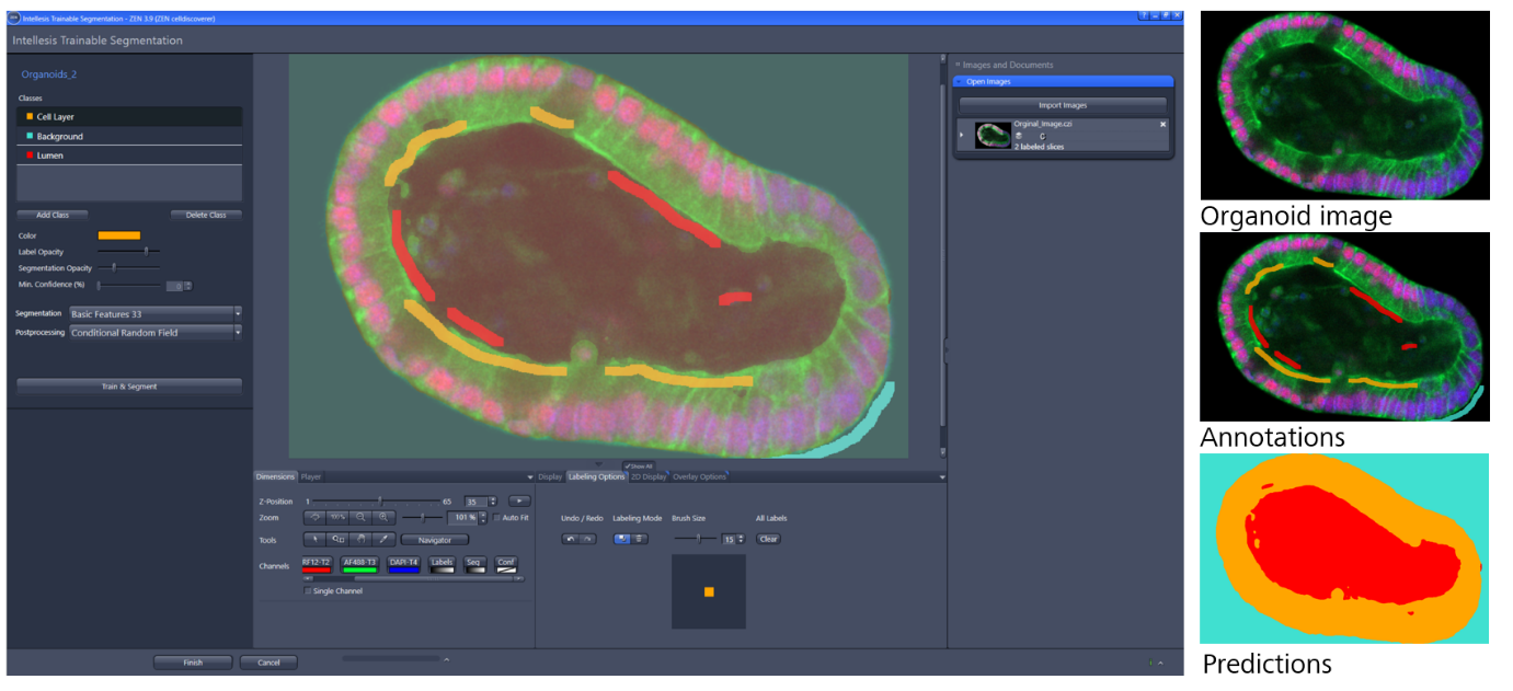 Intellesis UI with organoid image, colored annotations and right panel labels Organoid image Annotations Predictions