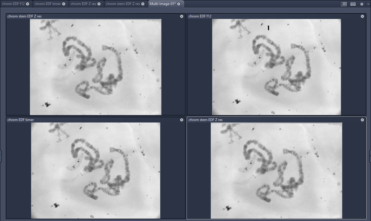 four grayscale images in a 2x2 split view; panels labeled chrom EDF f12, chrom EDF timer, chrom stem EDF Z res