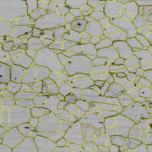 Grayscale micrograph showing polygonal cells outlined in yellow with scattered dark spots.